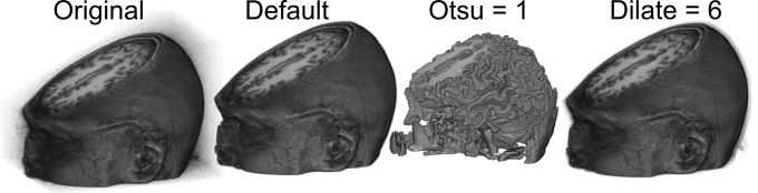 extractmri.jpg