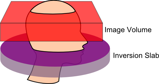 asl_mri